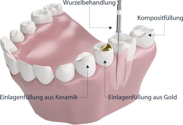 Gepflegte Zähne können ganz schön teuer werden